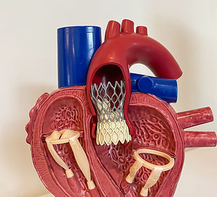 cardiac model of Transcatheter aortic valve implantation (TAVI) for people education.jpg