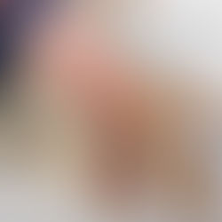 Lenfödem: Fizik Tedavi ve Masaj