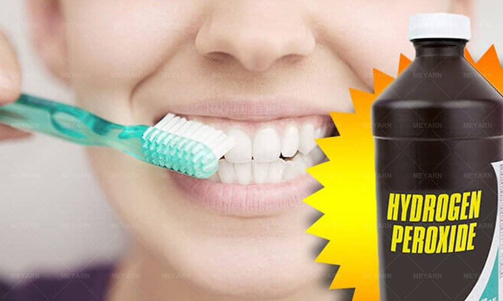 Hydrogen Peroxide in Teeth Whitening