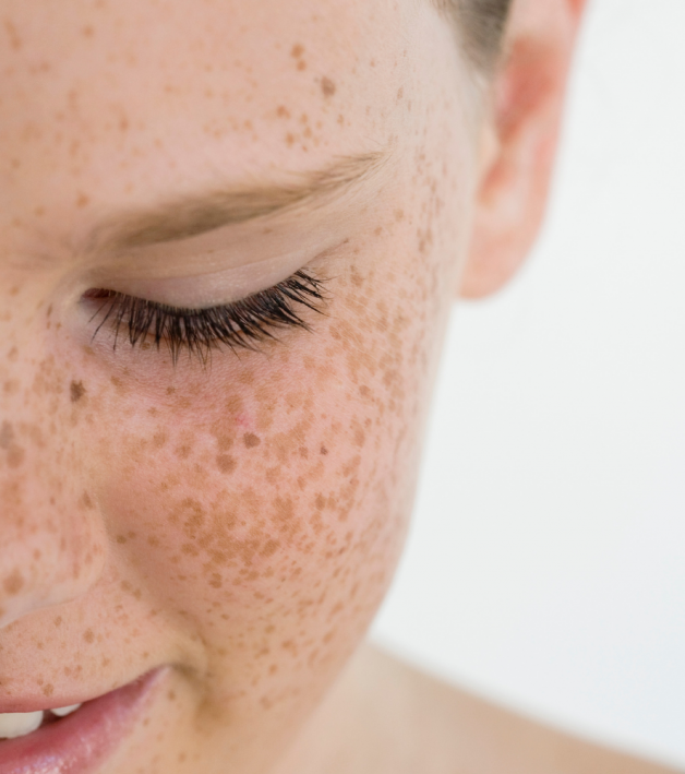 A close-up of a young girl’s face with freckles, eyes closed, and long, dark eyelashes.