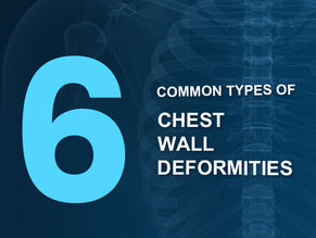 6 Common Types of Chest Wall Deformities
