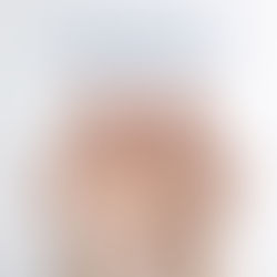 hyperhidrosis types and treatments