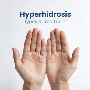 hyperhidrosis types and treatments