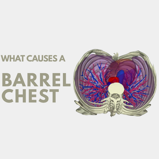 What Causes A Barrel Chest?