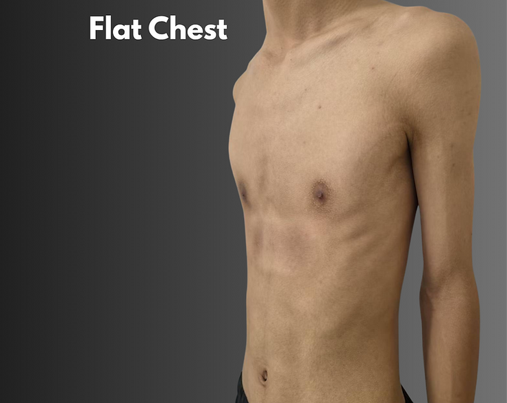 flat chest