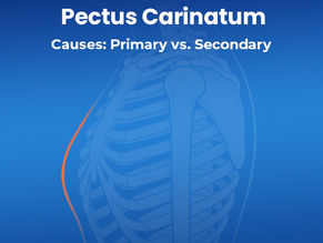 pectus carinatum causes