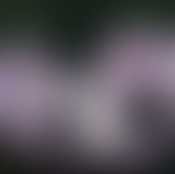 What is Pectus Excavatum?