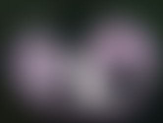 What is Pectus Excavatum?