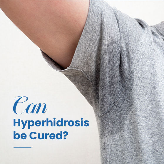 Can Hyperhidrosis be Cured?