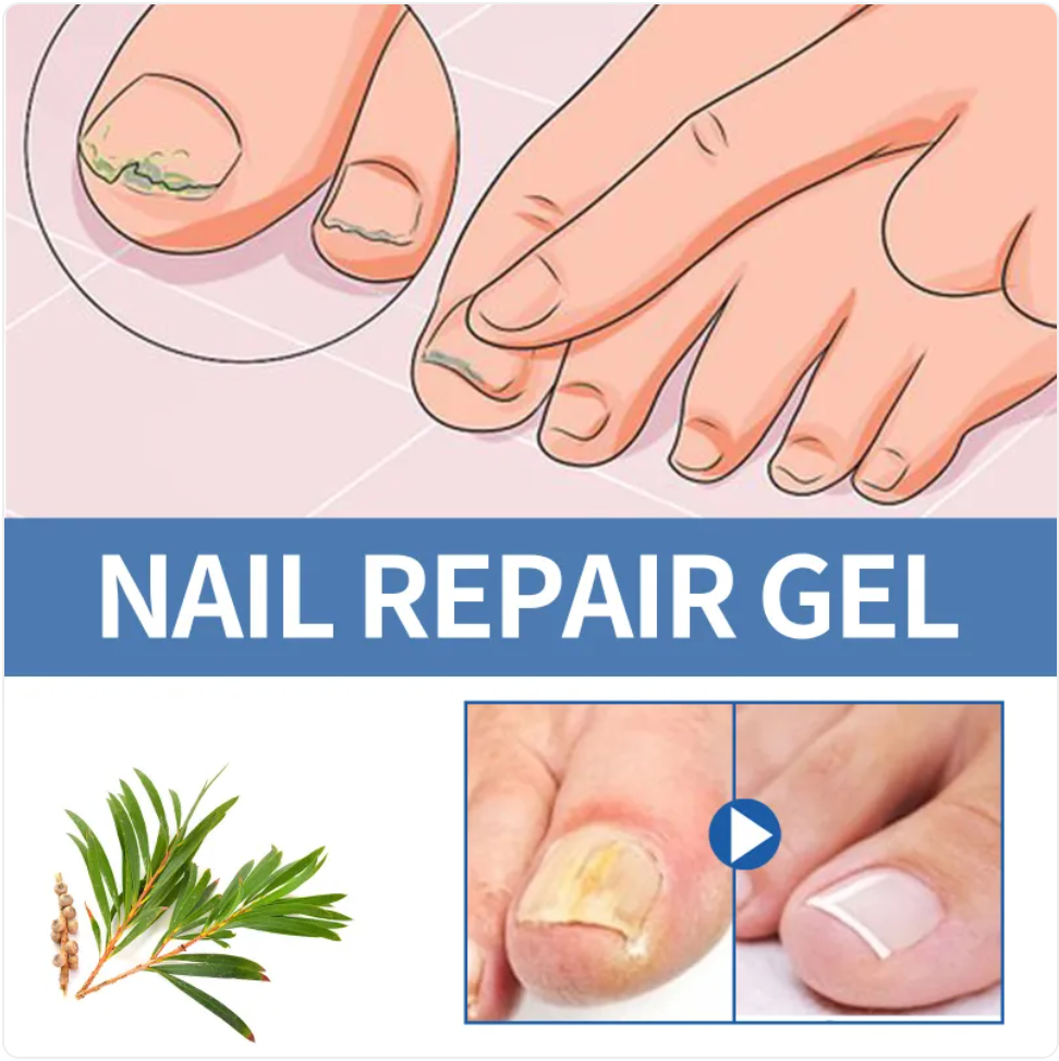 Miniaturbild: Nail Fungus Repair Gel