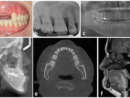Image showing Representative examples of image types included in the datasets (OMF).