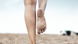 4 Most Common Causes of Heel Pain