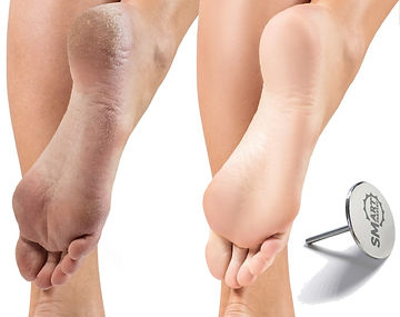 smart_pedicure_charm.jpeg