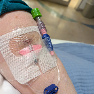 Things have been not awesome