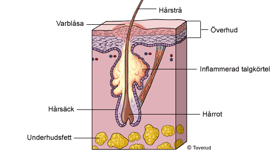 Ansiktsbehandling Fuktbehandling, Östermalm Stockholm