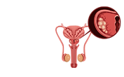 prostate.png