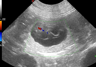 00036719_00090479_DICOM_US_2025_10_29_0000853832 2.jpg