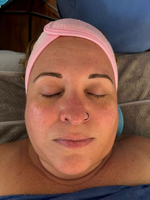 How Personalized Facials Can Transform Your Skin: From Acne to Anti-Aging