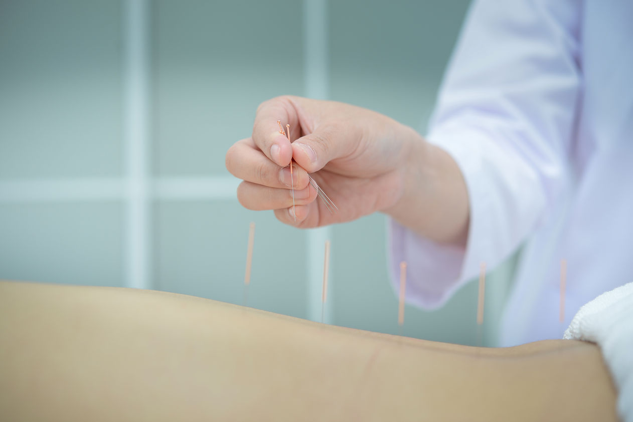 closeup-patient-getting-acupuncture-from