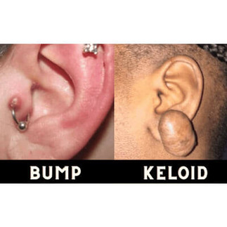 Reazioni al piercing