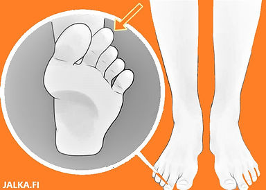 Mortonin varpaat.jpg