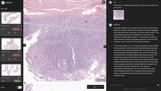 MODELLA AI'S GENERATIVE AI CO-PILOT PATHCHAT RECEIVES FDA BREAKTHROUGH DEVICE DESIGNATION