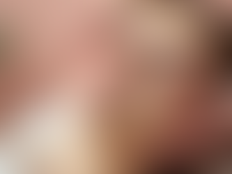 A Holistic Approach to Facial Healing at Woods Rose Skincare