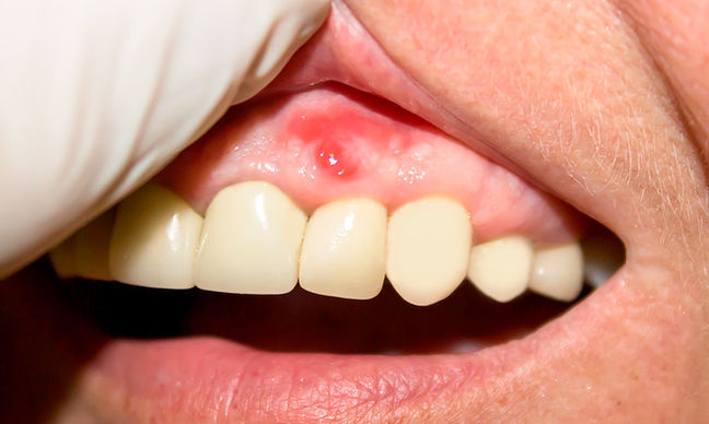 periodoncia-4.jpg