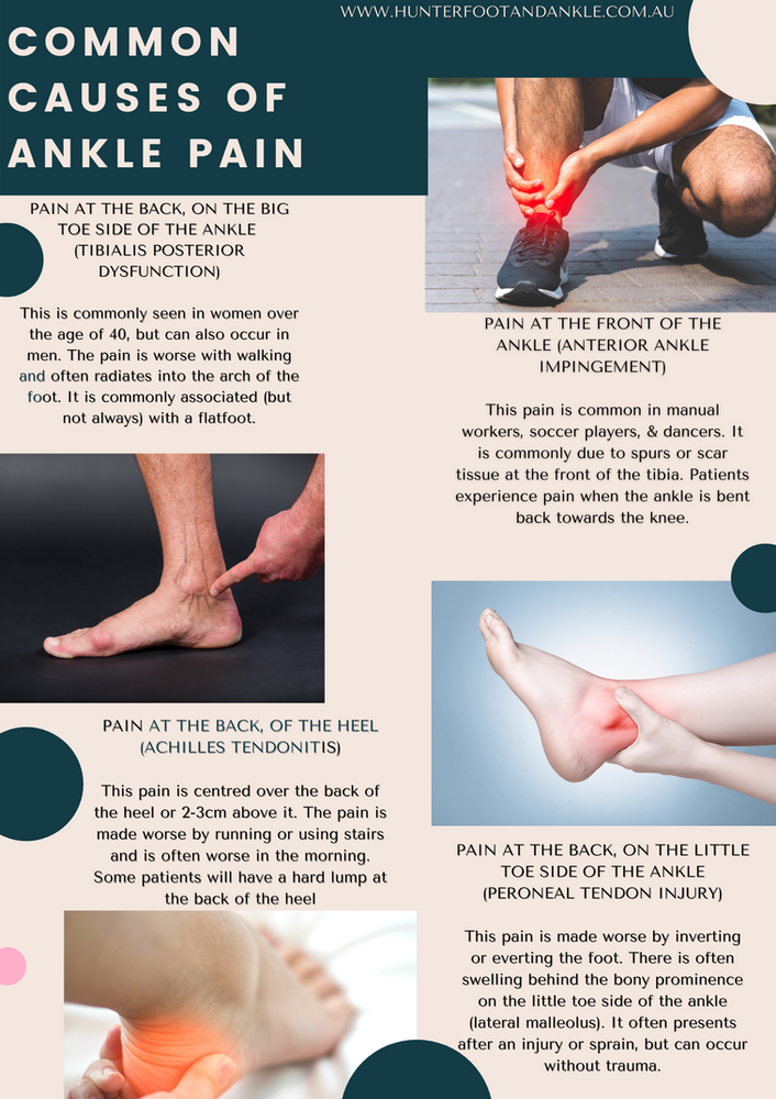 Common Causes of Ankle Pain