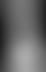 Total Ankle Replacement in Newcastle, Central Coast & Lake Macquarie