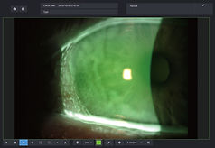 olhos vermelhos.jpg