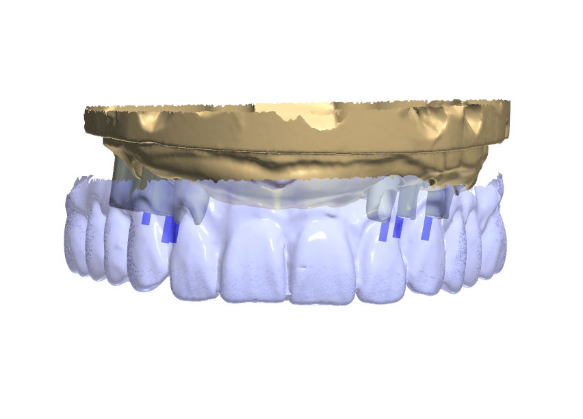 Northshore Dental Labs | CAD/CAM