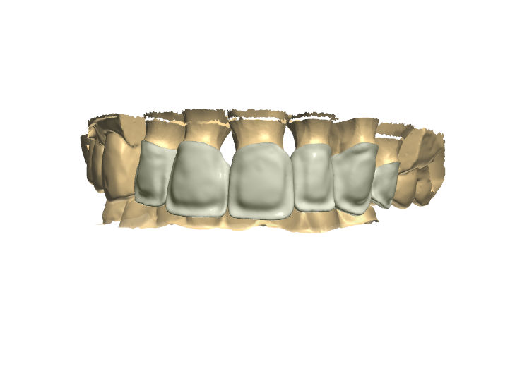 Northshore Dental Labs | CAD/CAM
