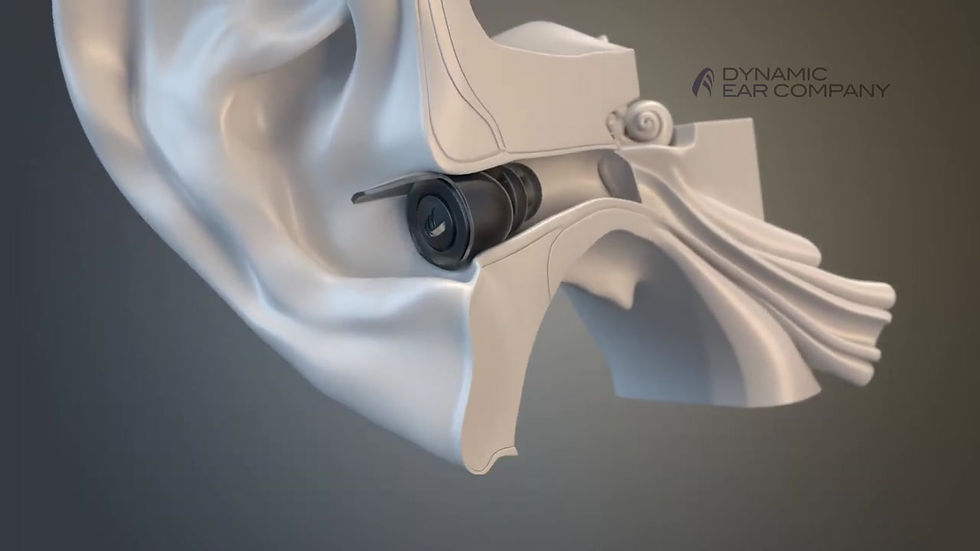 Thumbnail: Video explaining how to insert the earplugs properly in the ear