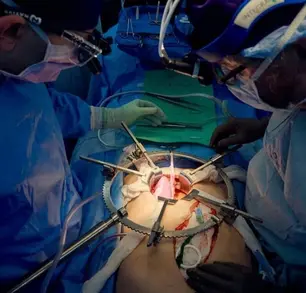 États-Unis: décès du receveur de la première greffe de rein de porc génétiquement modifié