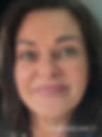 Perfect Derma Peel two weeks post peel, clear glowing skin