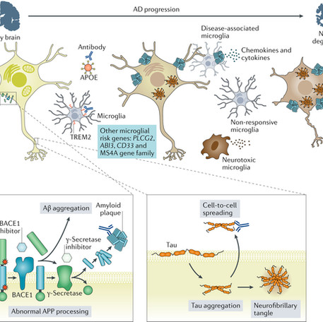 how to prevent alzheimer's