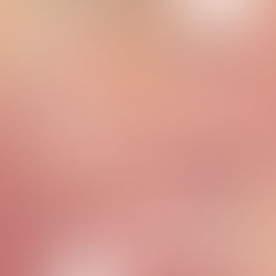 La Stéatose Hépatique : Définition, Types et Symptômes