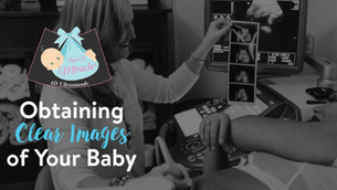 Experience the Miracle of 3D/4D Ultrasound at View A Miracle