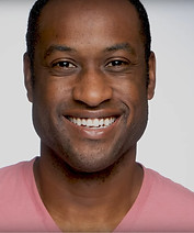 Zoom Professional Whitening Before After Spinel Dental Hamilton 5 .jpeg