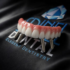 Spinel Dental Hamilton - Affordable All On 4 Dental Implants provider in Hamilton.jpg