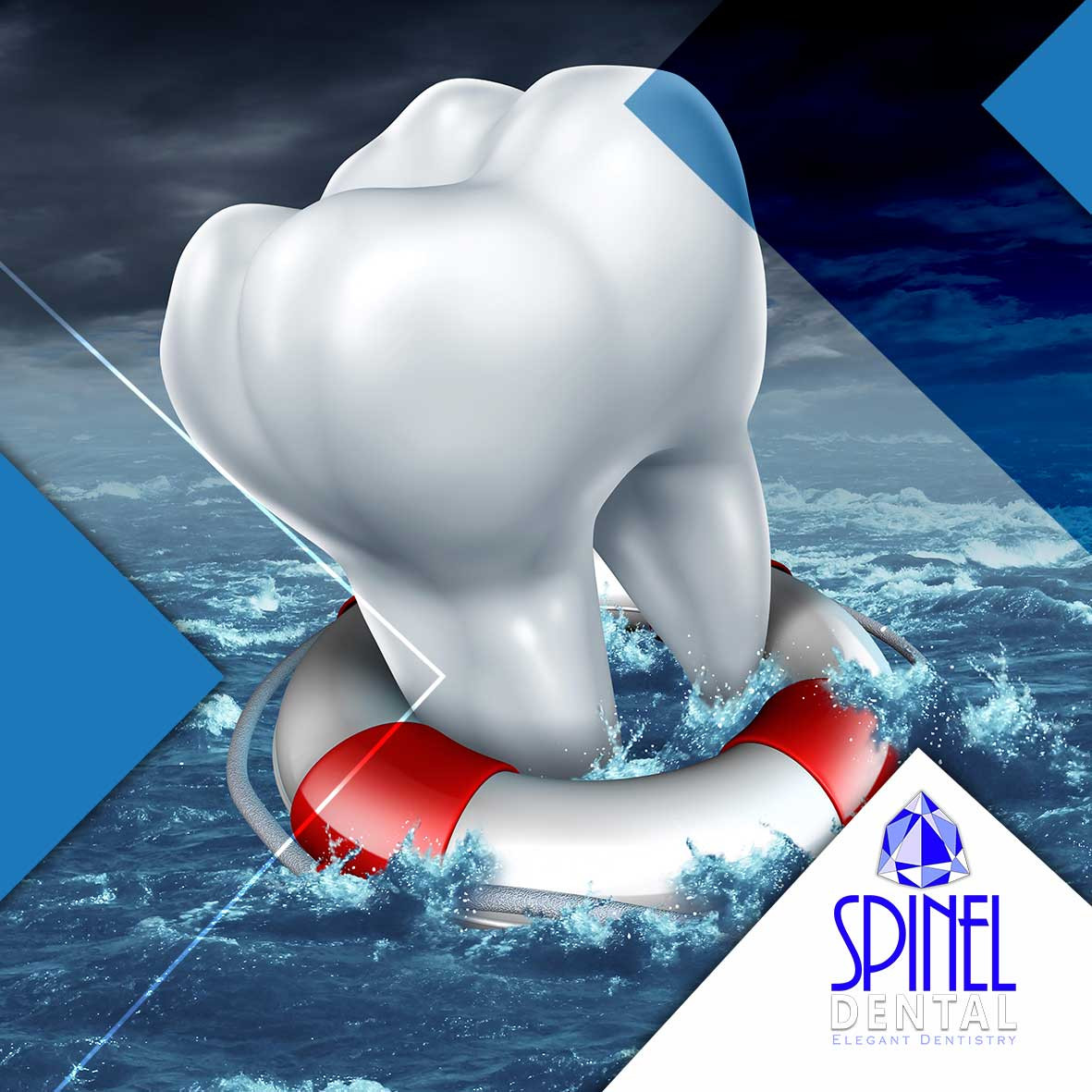 Emergency Dentist Hamilton ON Dental Emergency Hamilton Mountain