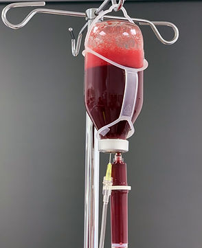 Angereichertes-Blut-scaled-q1gr22s8s9me5dsw7zos5ttolvv1w2i2xgno71oowg.jpg