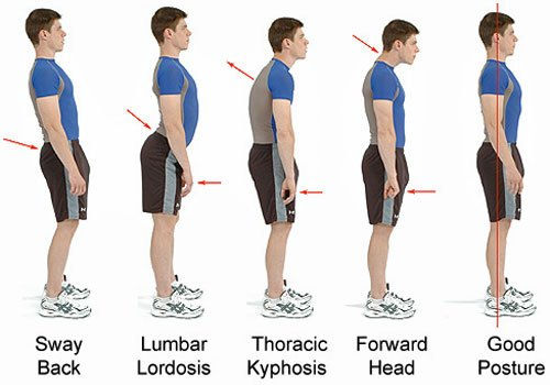 Postures