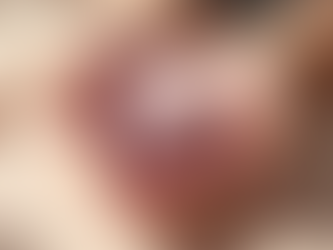 Radiant Skin Solutions: Alexis Aesthetics Bunbury WA