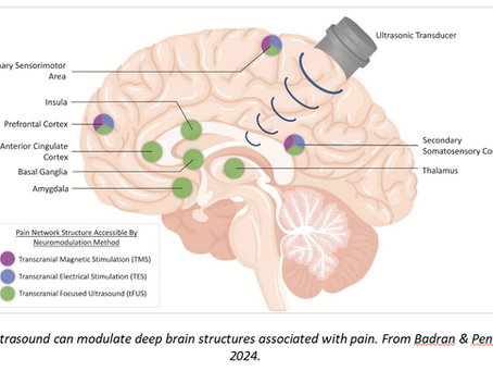 Ultrasound Neurotechnology: A Quiet Revolution in Mental Health Treatment