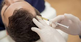 PRP Hair Rejuvination