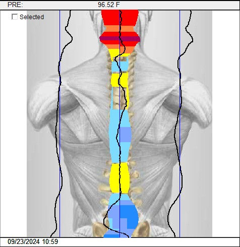 Pediatric posture assessment showing spinal alignment before chiropractic care.