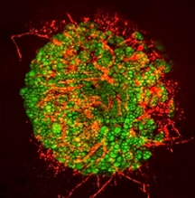 Tumor organoid microscope image