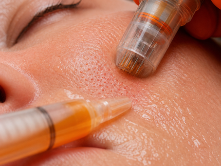 Microneedling with PRP: Benefits, Procedure, and Aftercare